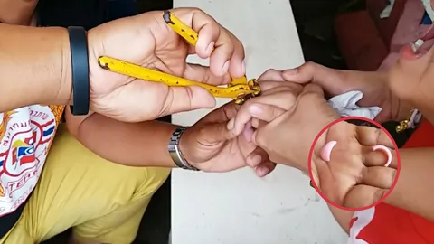 แนะซื้อขนมแถมของเล่นต้องดูให้ดี แหวนพลาสติกติดนิ้วเด็ก เกือบเอาไม่ออก (คลิป)