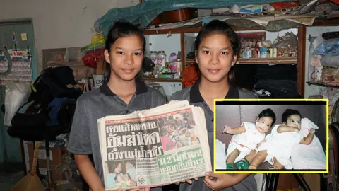 หน้าเหมือนกันมาก! 15 ปีพี่ไฟว์น้องโฟร์ท แฝดสยามผ่าแยกร่างโตเป็นสาวแล้ว