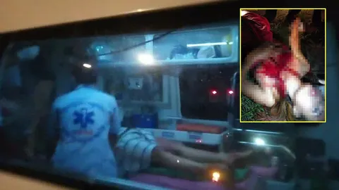 ก๊วนหญิงโหด ตบกันหน้าผับ ชักคัตเตอร์กรีดอกสาว 21 แผลเหวอะเลือดท่วม