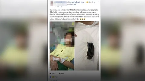 นี่คือการรักษา! ผอ.แจงยิบ ดราม่าสาวถูกงูกัด ใส่เครื่องช่วยหายใจ รอ 4-5 ชม. ถึงฉีดยา