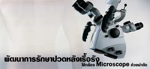 พัฒนาการรักษาปวดหลังเรื้อรังใช้กล้อง Microscope ช่วยผ่าตัด