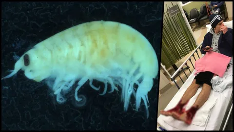 เฉลยแล้ว! ผู้เชี่ยวชาญไขปริศนา ตัวอะไรแทะขาหนุ่มออสซี่จนเลือดอาบคาหาด