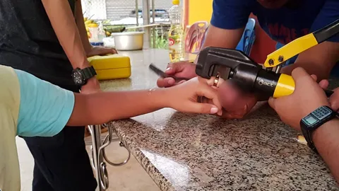 อุทาหรณ์! ป.4 ซื้อแหวนใส่เอง รัดนิ้วบวมเป่ง กู้ภัยใช้เครื่องตัดช่วย