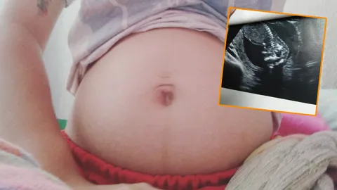 สุดเศร้า! แม่ร่ำไห้หนัก ยอมดับชีวิตลูกด้วยเหตุเหลือเชื่อ แพทย์เผย 1 ในหมื่นที่เจอแบบนี้