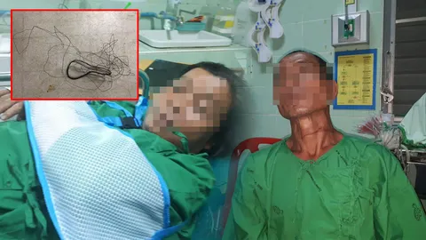 หนุ่มดอยเต่าหวิดดับ เจอลวดขึงกลางถนน ตร.คาดฝีมือวัยรุ่นคะนองในพื้นที่