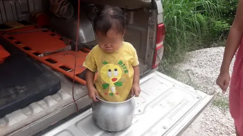 ไม่ใช่จินนี่! หนูน้อยขวบกว่าขาติดหม้อนึ่งข้าวเหนียว กู้ภัยฯช่วยปลอดภัย