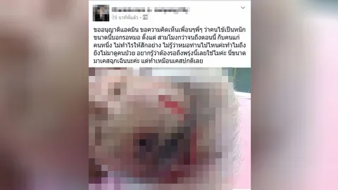 สาวโพสต์ยายตกบันไดหัวแตก แผลฉกรรจ์ นอนรอ 5ช.ม. ก่อนหมอมาเย็บกว่า30เข็ม