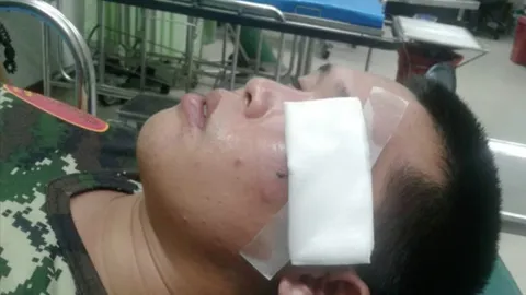 แม่พลทหารร้อง ลูกถูกนายสิบ-ทหารยศจ่า ลวงไปให้คนทำร้าย ไหว้ขอยังซ้อมต่อ