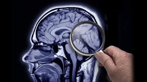 วิจัยพบเซลล์ที่ไม่คาดคิดว่าจะสำคัญต่อการพัฒนาสมอง