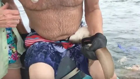 สุดหวาดเสียว ชายมะกัน โดนฉลามงับพุงสยอง ไม่ยอมปล่อย (คลิป)