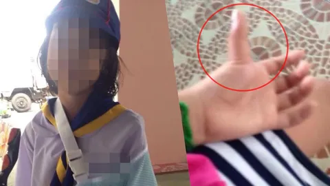 หัวอกคนเป็นแม่! ลูกสาวถูกครูตีนิ้วหลุดเพราะทำสีตก ผอ.ขอให้ย้าย ร.ร.