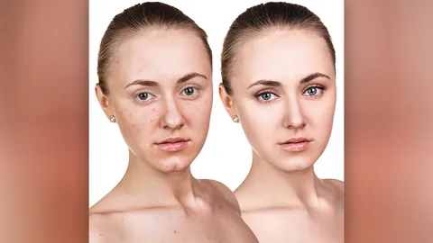 หยุดก่อนเละ! ผิวบอบบางชะมัด ใช้อะไรก็แพ้อ่านทางนี้!