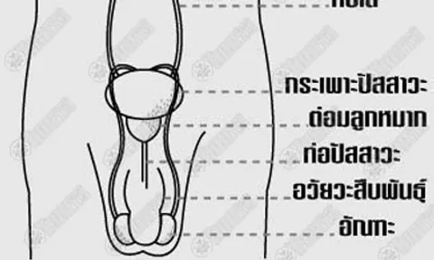 ตัดเนื้อออกตรวจ มะเร็งต่อมลูกหมากก่อให้หย่อนสมรรถภาพ