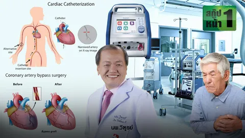 รู้จักบายพาสหัวใจ เลี่ยงเสี่ยงโรคหัวใจ
