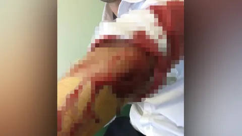 โรคจิตแอบถ่ายผู้หญิง ฟาดหนุ่มพลเมืองดีไม่ยั้ง ต่อหน้ารปภ.รถไฟฟ้าบางพลู