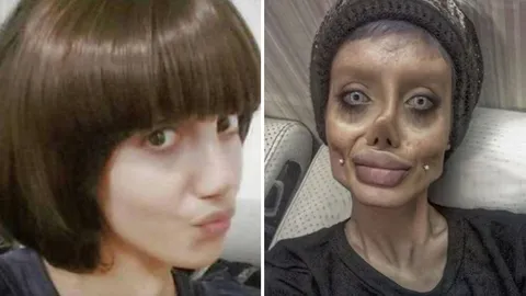 เงิบ! สาวอิหร่าน รับแล้ว โกหกทั้งเพ ศัลยกรรมหน้า50หนเลียนแบบ‘โจลี่’