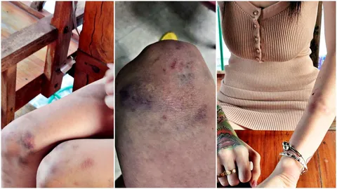 'ฟลุ๊คศรี มณีเด้ง' ขอความเป็นธรรม อ้างตร.ทำเกินเหตุ 'ตบ ดึงผม รัดคอ'