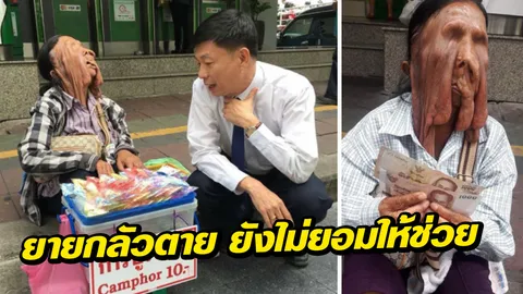 ยายตาบอดกลัวตาย ยังไม่ยอมให้ช่วยผ่าตัด