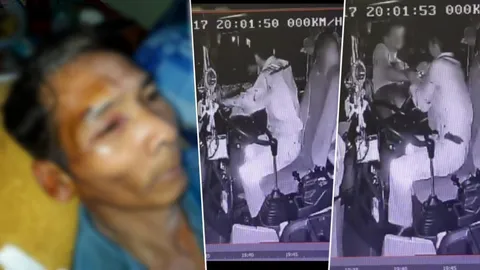 เปิดคลิป ลุงถูกต่อยคิ้วแตก แข็งใจซับเลือดไปแจ้งความ ถกสนั่นใครผิด-ถูก