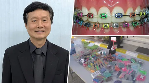 จัดฟันออนไลน์เสี่ยง ‘มะเร็ง’ แฟชั่นหนุ่มสาว เตือนอันตรายสั่งปราบทั่วปท.