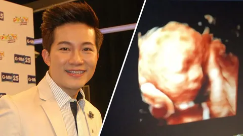 โสมชบาจ๊ะจ๋า 22/01/61