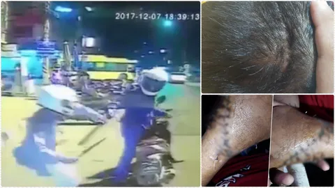 หวั่นมือใช้ไม่ได้! หนุ่ม16 ถูกฟันเย็บ 200 เข็ม ผกก.ยันเร่งล่า 2 มือมีด