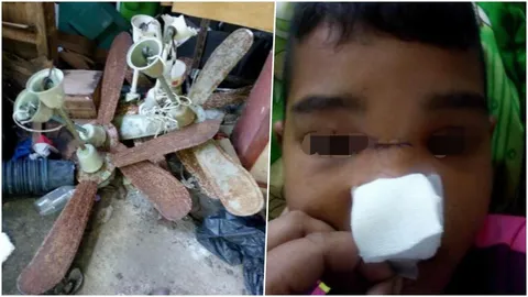 แม่ร้องพัดลมเพดานหมดสภาพตกใส่เด็ก 13 ดั้งหัก ร.ร.ให้เงิน 1 พันเงียบหาย