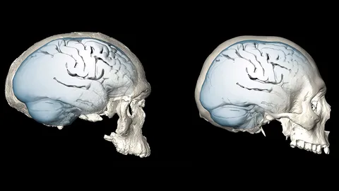 วิจัยความเปลี่ยนแปลงรูปทรงสมองของมนุษย์