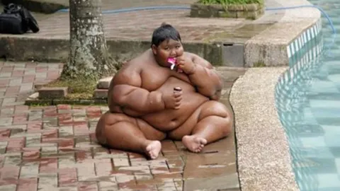 ชีวิตเด็กตัวหนักที่สุดในโลก