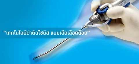 "เทคโนโลยีผ่าตัดไซนัส แบบเสียเลือดน้อย"