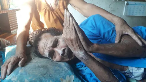 วอนช่วยตาป่วยมะเร็งปาก อาศัยลำพังกับยาย มีแค่ยาฟรีเยียวยาอาการ