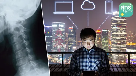 “กระดูกคอเสื่อม” อีกหนึ่งโรคที่ควรรู้จัก (ตอน 2)