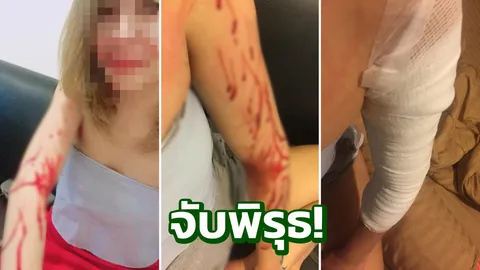 จ่อโดนโทษอ่วม! เพจดังเปิดคลิปวงจรปิด แฉ สาวถูกกรีดแขน 43 แผลกุเรื่อง