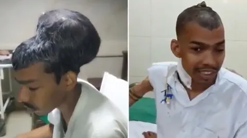 ตามองไม่เห็นแล้ว!หมออินเดีย ชุบชีวิต ผ่าตัดเนื้องอกในสมองใหญ่สุดในโลก 