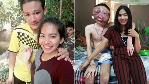 ให้รักเยียวยา! 'โพ' หนุ่มป่วยมะเร็งตากว่า 2 ปี มีแฟน-ครอบครัวเป็นกำลังใจ