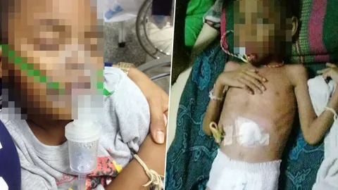 สุดสงสาร 'น้องอะตอม' วัย 6 ขวบ ติดเชื้อที่สมอง ช่วยเหลือตัวเองไม่ได้