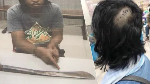 อ้างพระนเรศวรสั่งฆ่า! คนบ้าคว้ามีดฟันเพื่อนบ้านและยายตัวเอง เจ็บสาหัส