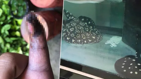 อันตราย! ดีเจเคนโด้ เล่าคนใกล้ตัวถูกพิษกระเบนเฉียดๆ นิ้วเน่า เกือบตาย