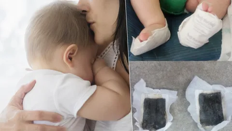 'จ่าพิชิต' เตือนพ่อแม่ อย่าใช้แค่ 'แผ่นสมุนไพร' แปะเท้าลูกเพื่อลดไข้