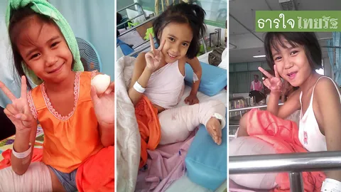 หกล้มครั้งเดียว! ‘น้องฟองเบียร์’ เป็นมะเร็งกระดูก ตัดขาเอาเนื้อร้ายทิ้ง