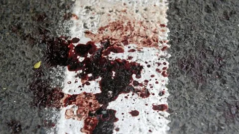 อึ้งทั้งผับ! หนุ่มโดนมีดปักกลางหลัง เข้ามาสั่งสุราดื่มหน้าตาเฉย