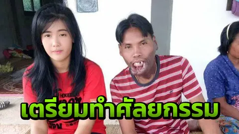 บุญมีเตรียมทำศัลยกรรม หมอใจดีทำให้ฟรี