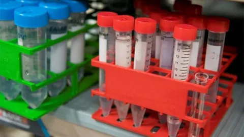 นักวิจัยญี่ปุ่นทดสอบปัสสาวะตรวจหามะเร็ง