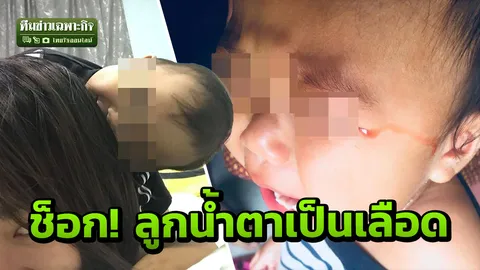 คนเป็นแม่เจ็บยิ่งกว่า! เหตุจากมือถือ ลูกวัยขวบกว่า น้ำตาเป็นเลือด 