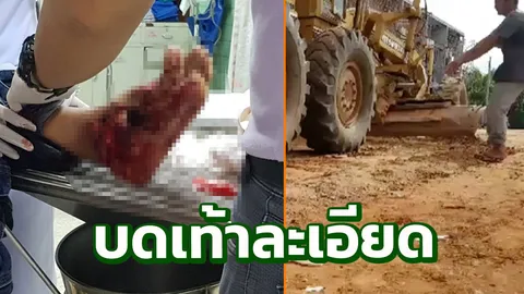 กู้ภัยกระบี่รุดช่วย สาวเมียนมาสุดซวย เจอล้อรถเกรดถนนบดเท้าเละ