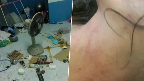 ถ้าเลิกตาย! สาวหนีสุดชีวิต แฟนบุกบีบคอ ฟกช้ำทั้งตัว ซ้ำพังห้องเละ