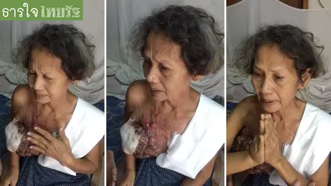 ‘ยายแมว’ สุดทรมานป่วยมะเร็งเต้านม ขอส่งสามีก่อน จากนี้จะตายก็ไม่เป็นไร
