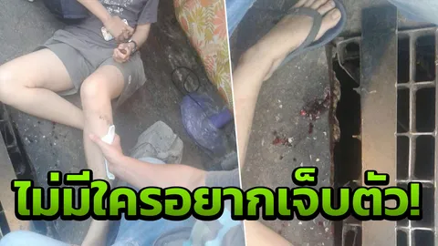 ใครรับผิดชอบ! นักศึกษา ม.ดังเชียงใหม่ ตกท่อระบายน้ำช้ำใจเย็บถึง 12 เข็ม