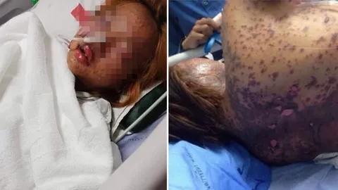 ไร้คนเยียวยา! สาวท้องรักษากับคลินิก เกิดแพ้ยารุนแรง ตัวบวม แท้งลูก