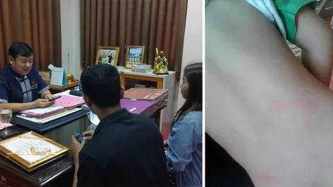 แม่ร้อง นอภ.บ้านผือ ลูก 3 ขวบ โดนครูใช้ไม้เรียวตีหลัง จนฟกช้ำ